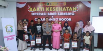 Kapolres Lhokseumawe Resmi Buka Operasi Bibir Sumbing Gratis, 20 Pasien Dapat Harapan Baru di HUT Bhayangkara ke-80